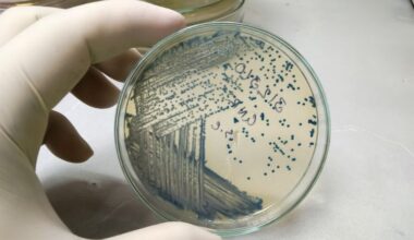 Upcycled plastic could facilitate production of Parkinson’s drug