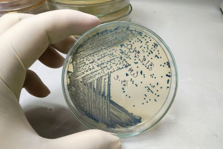 L-DOPA terephthalic acid