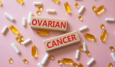 Long-term aspirin use is associated with lower ovarian cancer risk