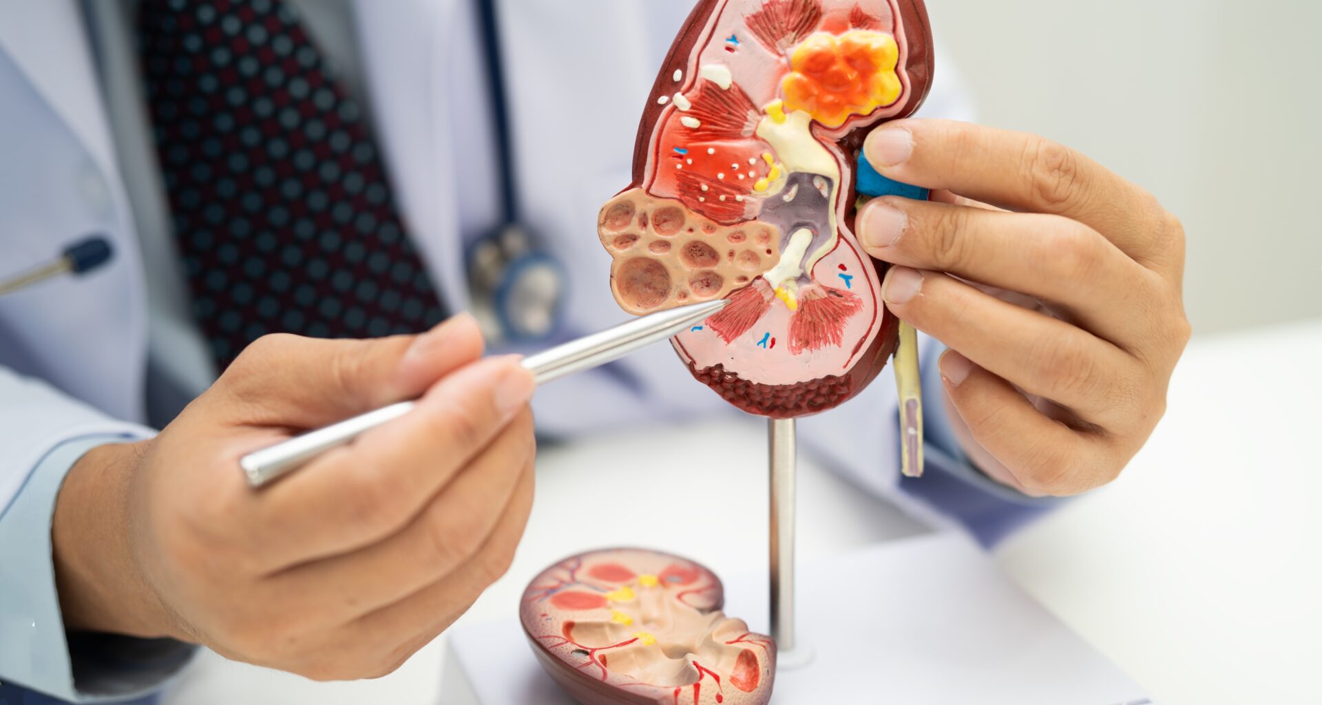 Gut microbes found to drive chronic kidney disease