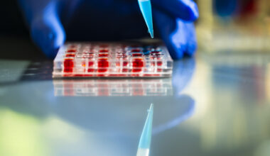 A hand holds a tray of small, red test liquids steady and places a pipette in one. The Image is reflected in a table surface.