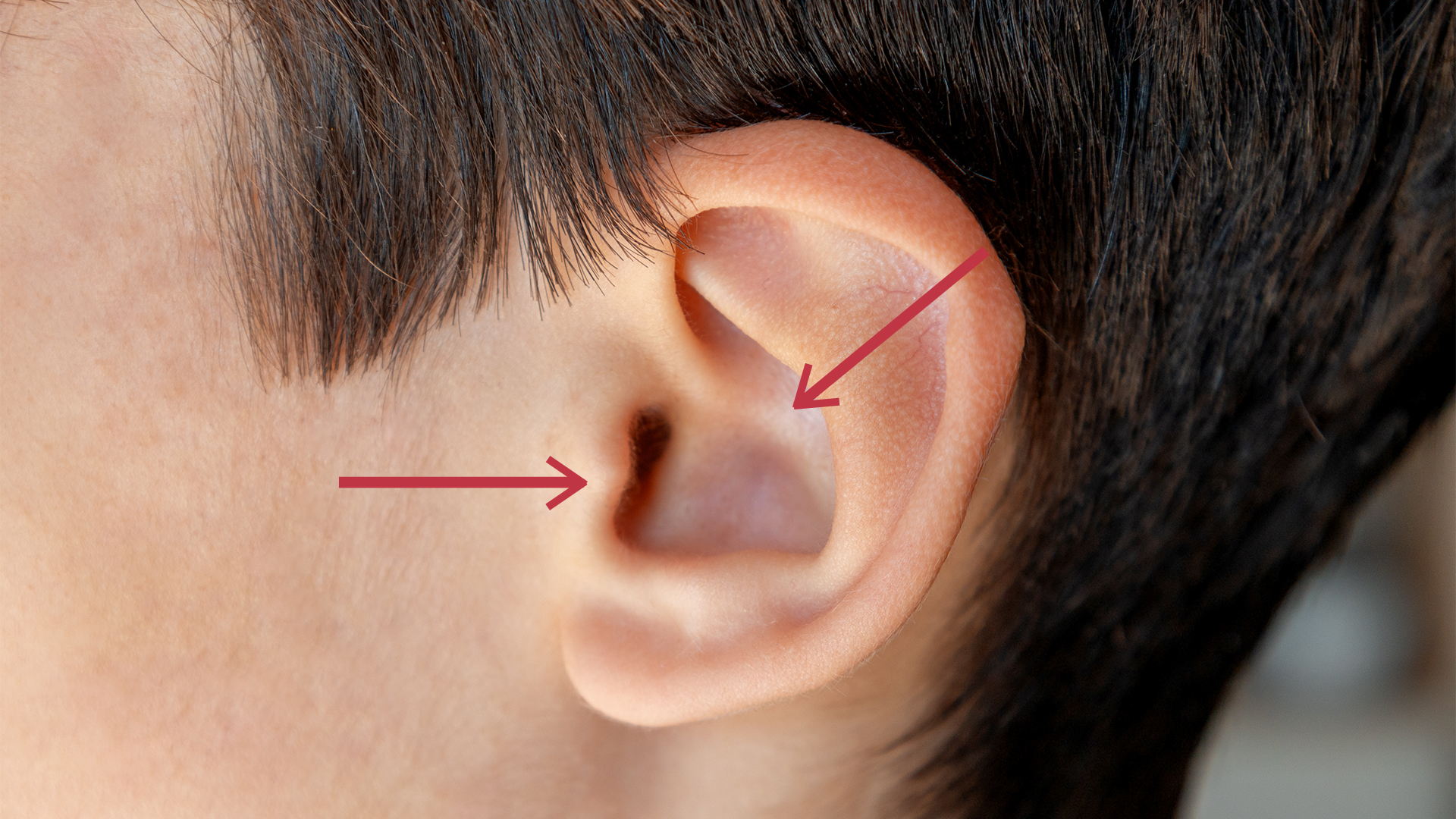 A close up of a man's ear with a red arrow indicating the tragus (the prominence pointing inwards) and the concha (the inner curve of the ear)