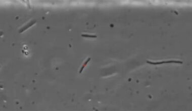 The wiggling of E. coli: Preventing infection through an investigation of swimming dynamics