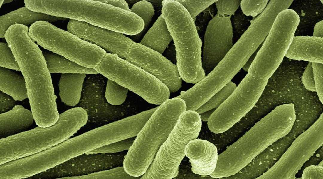 E Coli in green by Gerd Altmann via Pixabay