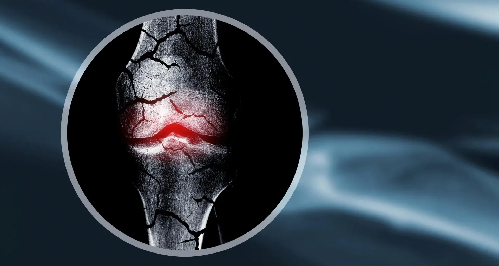 Scientists create cartilage scaffold that helps the body regrow bone