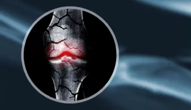 Scientists create cartilage scaffold that helps the body regrow bone