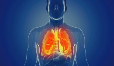 Inhaled Therapy For Lung Inflammation Post-Infection