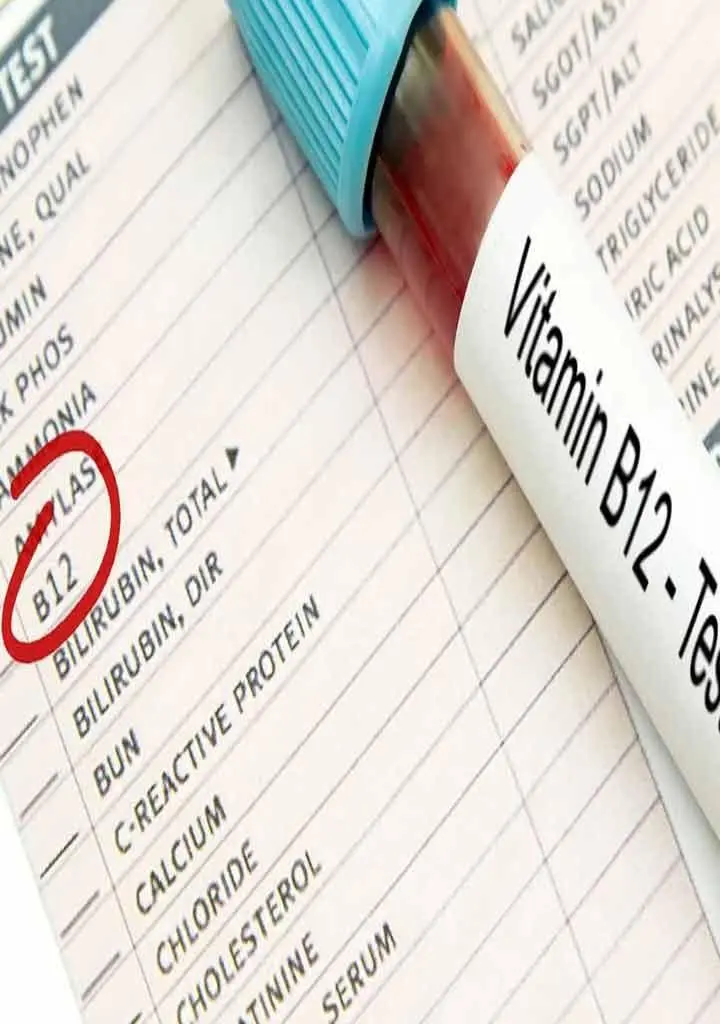 vitamin b12 deficiency signs body warning symptoms | Web Stories