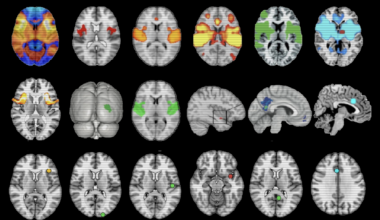 ‘Overdue’ debate unfurls over neuroimaging method