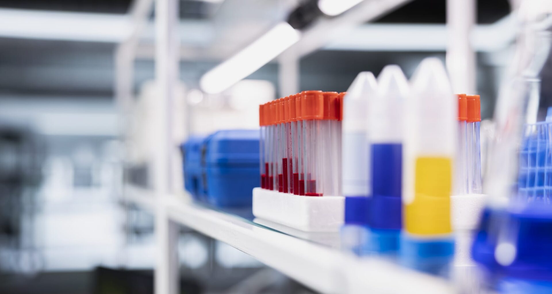 New Blood Test Detects Active and Infectious Tuberculosis