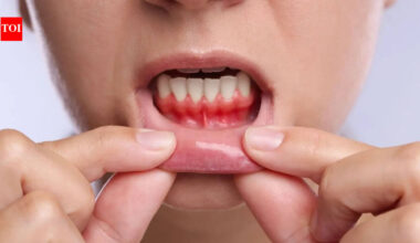 Gum Health: Bleeding gums may signal more than oral disease: How gum health is linked to heart risk and inflammation |