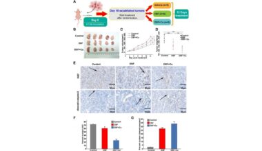 Metabolic Enzyme Identified as a Selective Vulnerability in APC-Deficient Cancer Cells