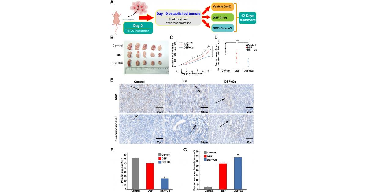 Metabolic Enzyme Identified as a Selective Vulnerability in APC-Deficient Cancer Cells