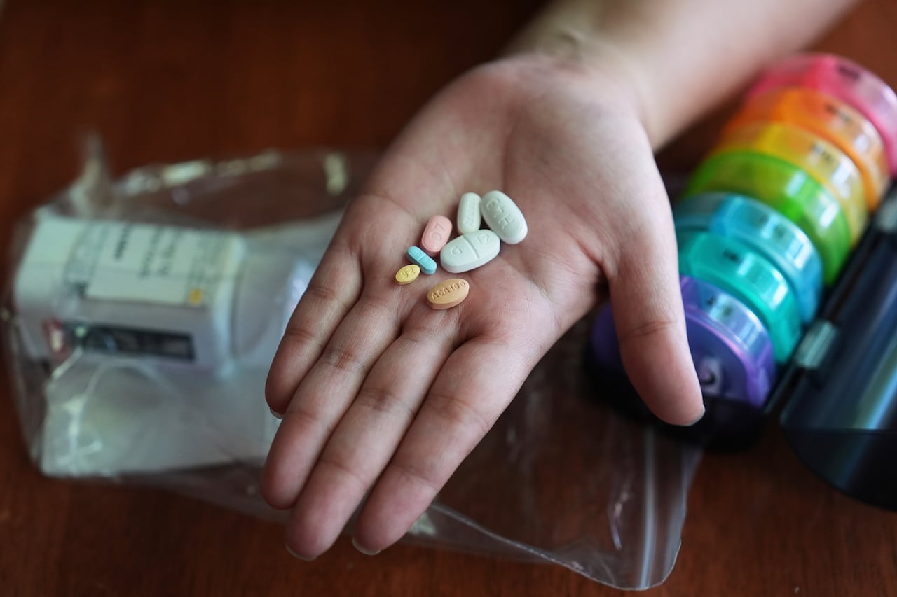 A woman holds a handful of pills.