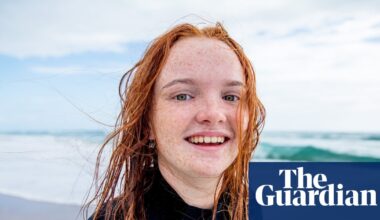 Red hair gene favoured by natural selection over last 10,000 years, study finds | Evolution