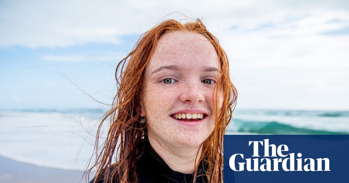 Red hair gene favoured by natural selection over last 10,000 years, study finds | Evolution