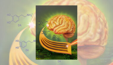 Stitching Precise Patterns - with Lasers