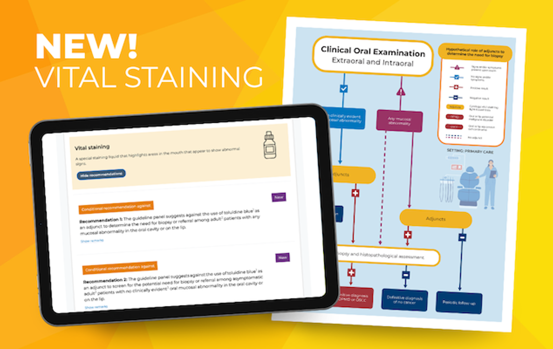 ADA guideline prioritizes clinical exam over vital staining in early oral cancer detection