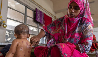 Measles outbreak kills at least 15 in Bangladesh