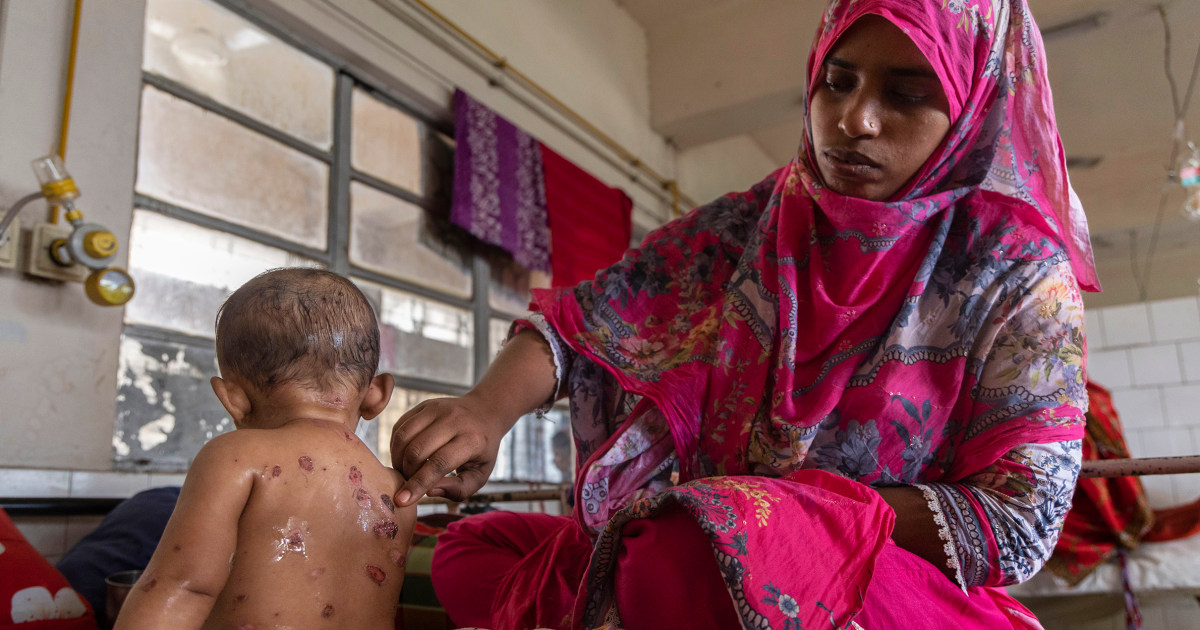 Measles outbreak kills at least 15 in Bangladesh