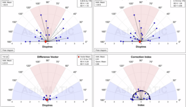 Vector analysis of a toric refractive multifocal IOL with continuous transitional focus technology: rotational and refractive outcomes, a pilot evaluation