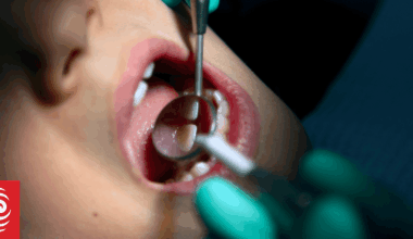 Campaign group costs universal free dental care, says NZ can afford it