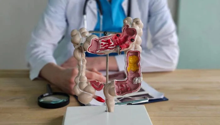 A doctor with a stethoscope sits behind a 3D model of the human digestive system on a desk