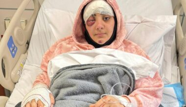 Wounded Lebanese journalist recounts agony when Israeli strike killed colleague - Haaretz