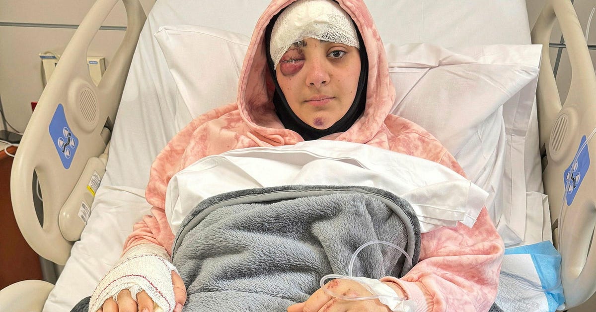 Wounded Lebanese journalist recounts agony when Israeli strike killed colleague - Haaretz