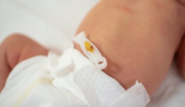 Umbilical Cord Antiseptics Reduce Neonatal Mortality