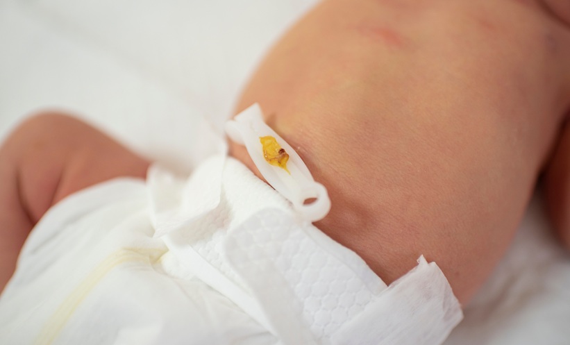 Umbilical Cord Antiseptics Reduce Neonatal Mortality