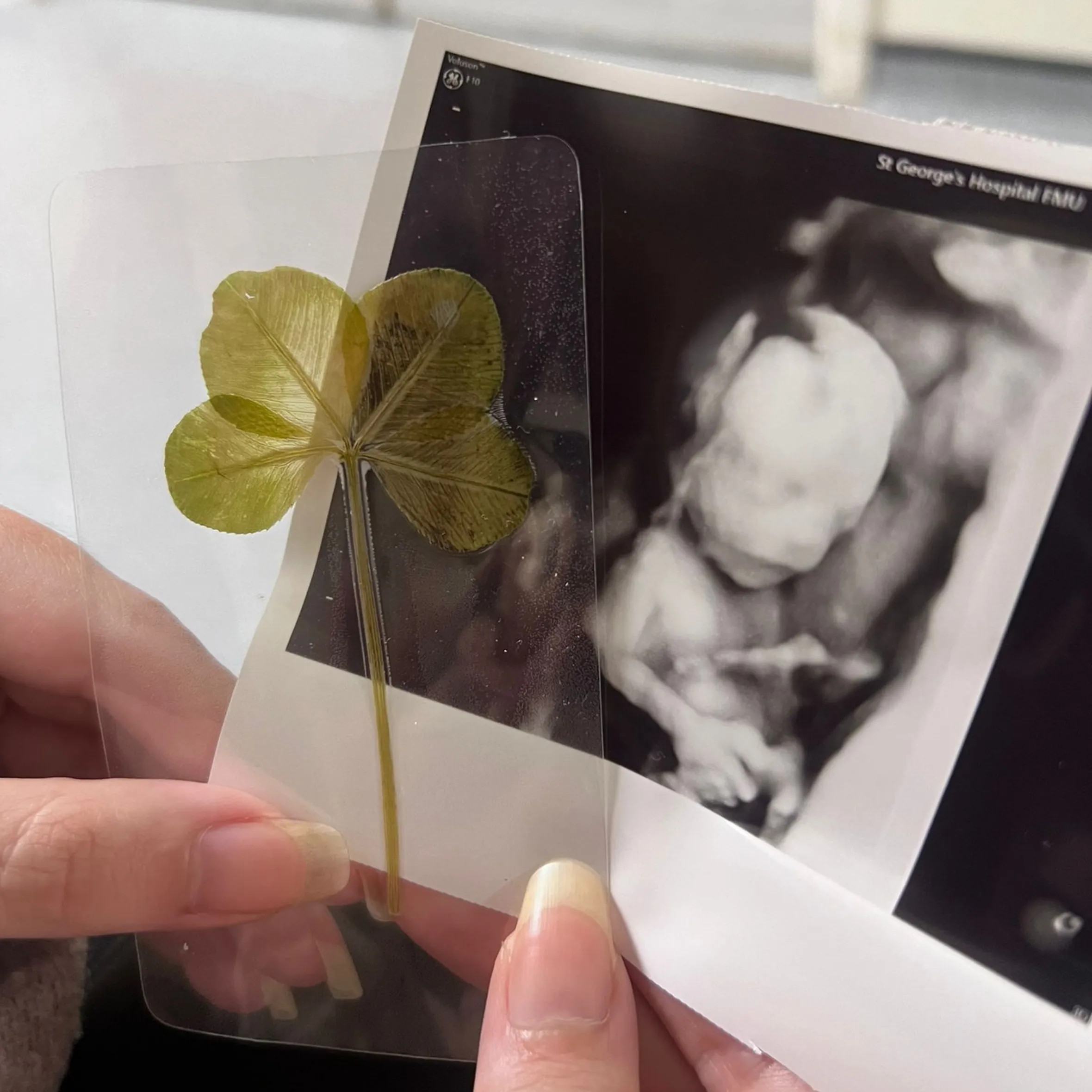 Two hands hold a sonogram of Arthur Ransom next to a preserved four-leaf clover.