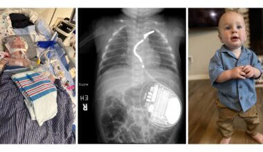 Speed, Expertise and Advanced Technology Combine to Save an Infant's Heart