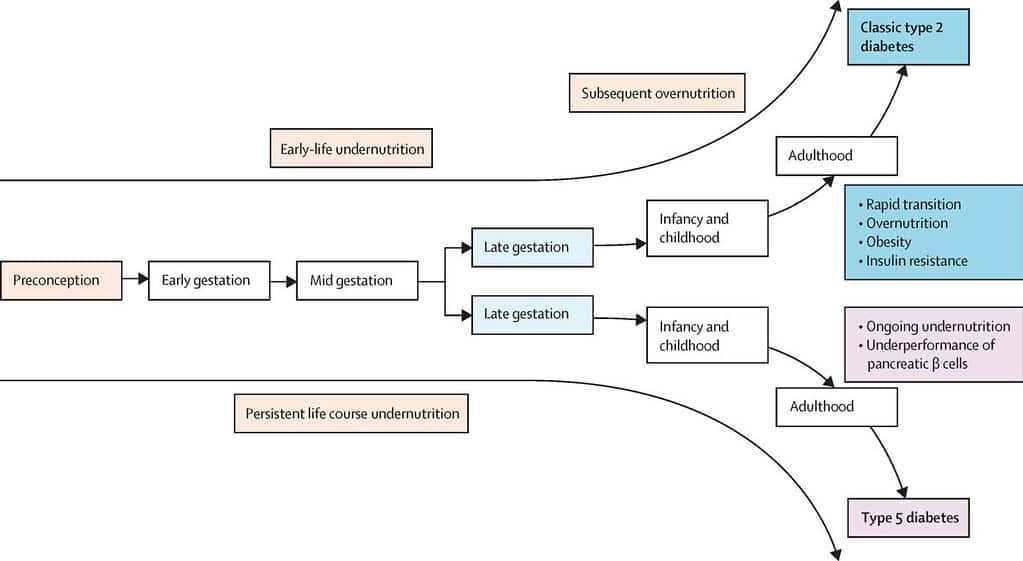 Diagram illustrating the progression of diabetes from early life to adulthood.