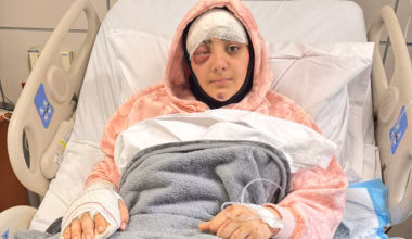 Wounded Lebanese journalist recounts hours of agony after Israeli strike killed colleague - The Washington Post