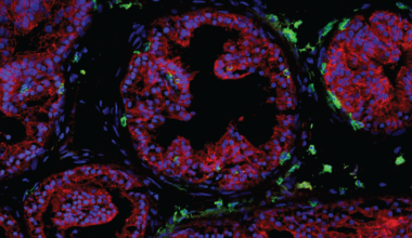 Scientists discover how key immune cells protect the prostate – lji.org