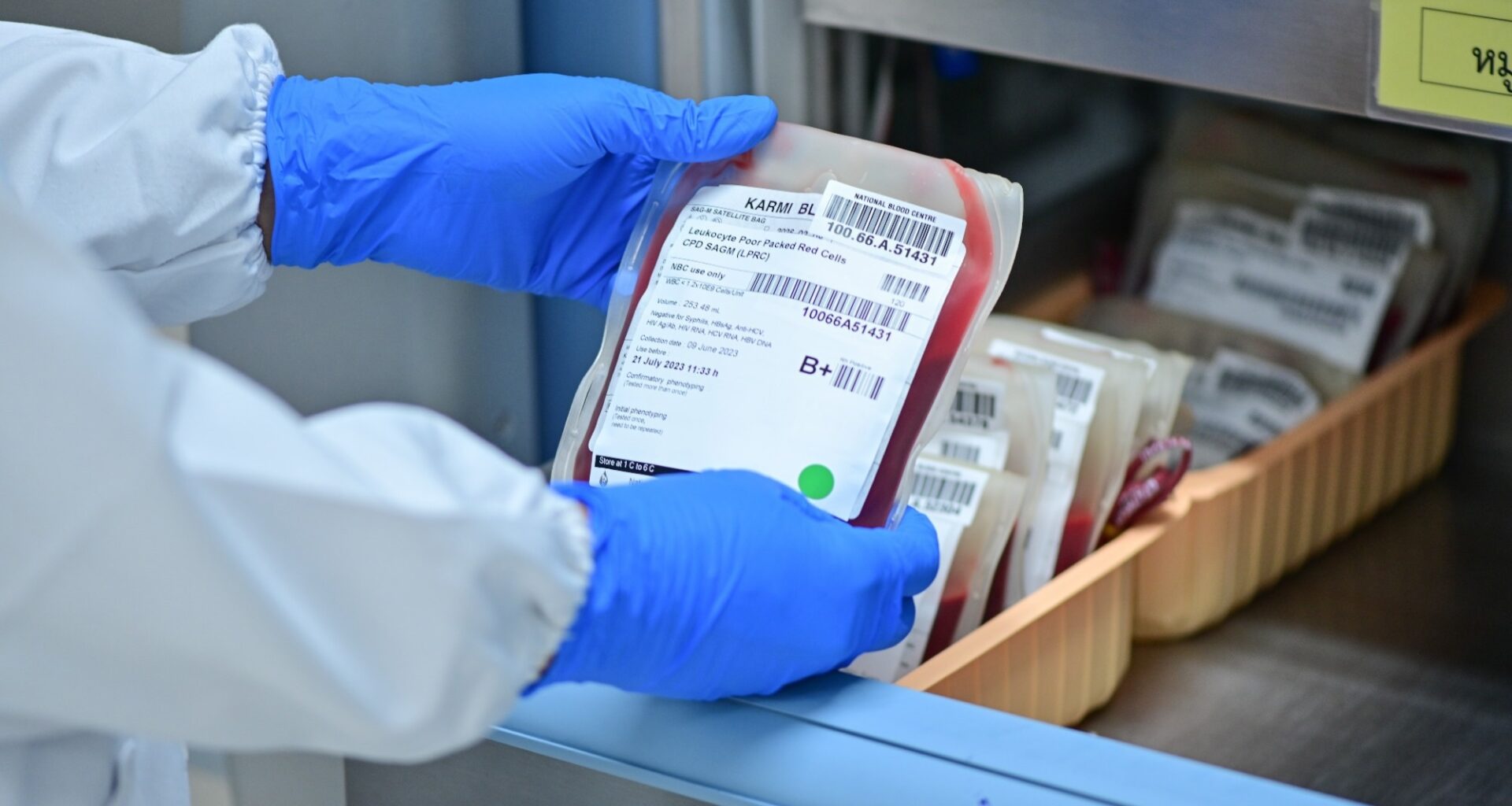 close up blood bag in laboratory medical concept. blood, donate blood, blood bank.