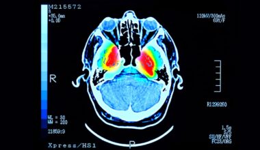 Abu Dhabi researchers identify molecule primed to boost fight against Parkinson's disease