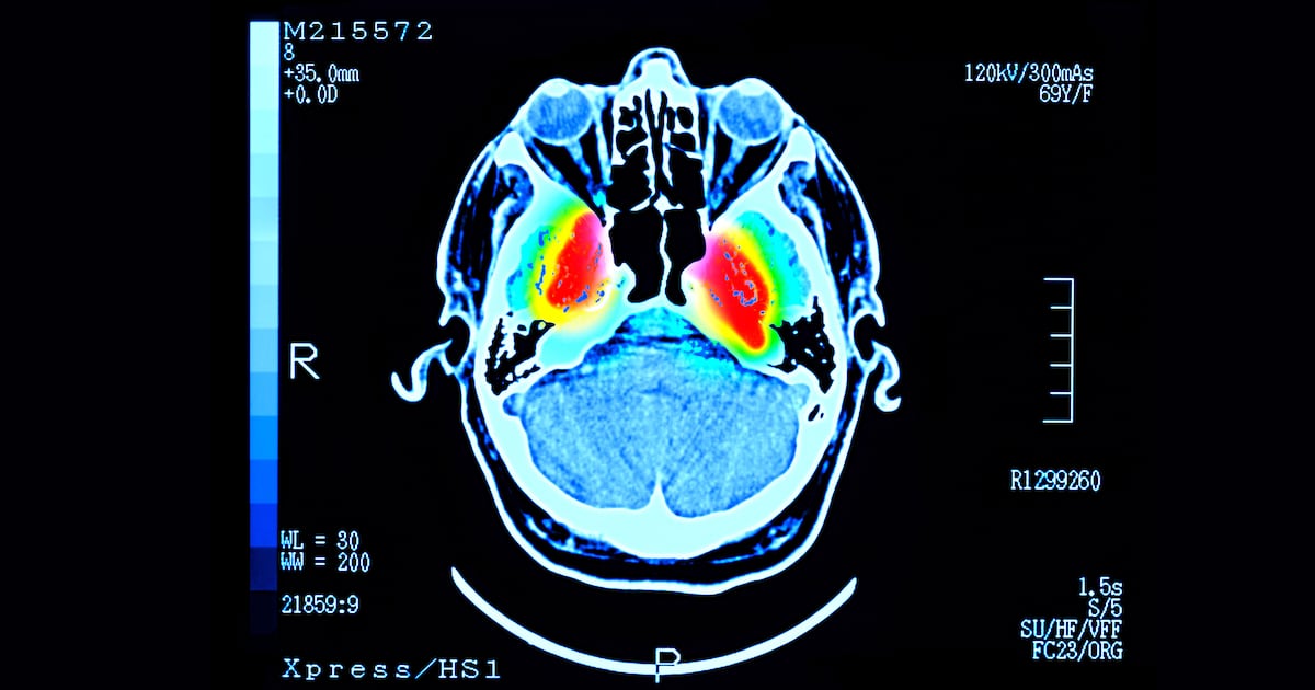 Abu Dhabi researchers identify molecule primed to boost fight against Parkinson's disease