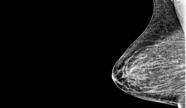 CEM Matches MRI in Breast Cancer Imaging Performance - EMJ