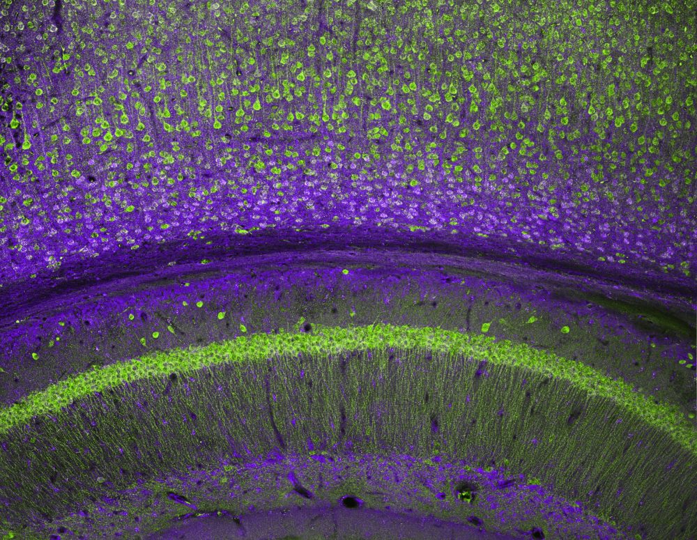 Scientists can now 'edit' brain circuits to enhance memory
