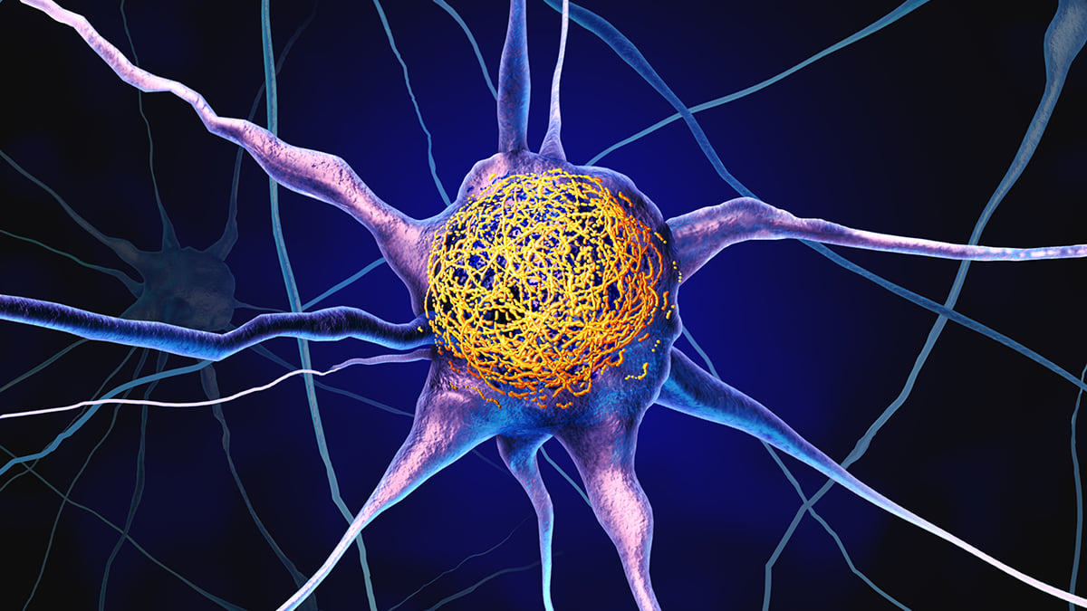 Common Vitamin May Reduce Buildup of Alzheimer's Proteins, Study Finds : ScienceAlert