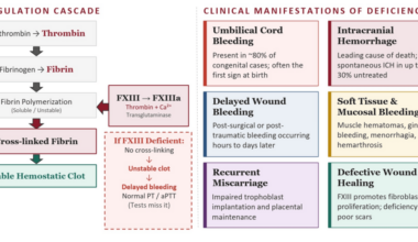 Anesthetic Management of a Patient With Factor XIII Deficiency Undergoing Encephaloduroarteriosynangiosis (EDAS): A Case Report and Literature Review