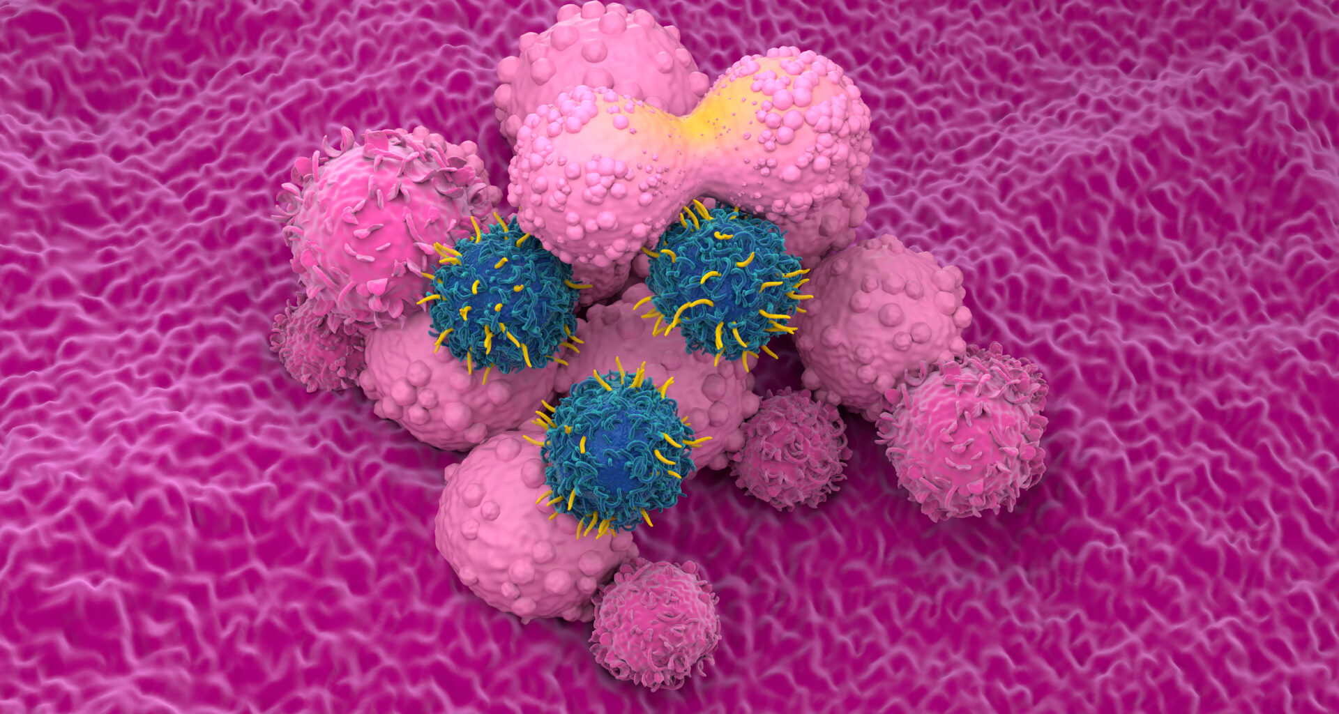 FDA Grants Traditional Approval to Brexucabtagene Autoleucel for Relapsed or Refractory MCL