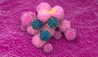 FDA Grants Traditional Approval to Brexucabtagene Autoleucel for Relapsed or Refractory MCL