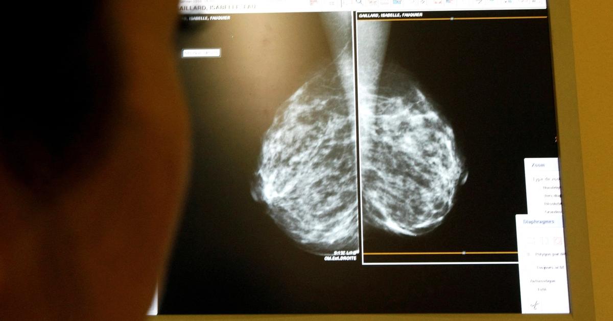 Hospitals consider replacing some radiologists with AI