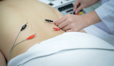 Electroacupuncture Relieves Cognitive Psychological Symptoms in Breast Cancer Survivors in Pilot Study