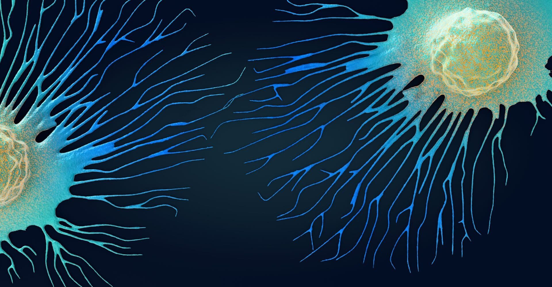 Migrating and spreading cancer cell - 3d illustration