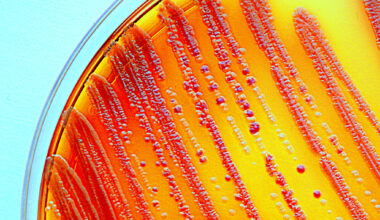 Enterobacteria grown on a selective agar plate. Part of the commensal microbion.