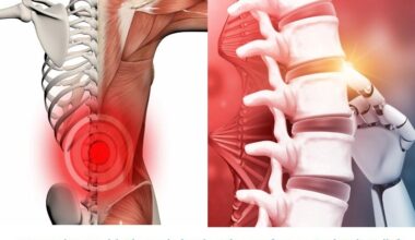 Integrating AI with Thermobalancing Therapy for Safe Treatment of Low Back Pain